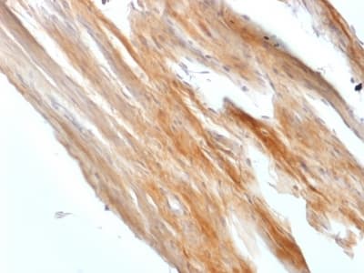 CALD1 / Caldesmon Antibody (clone CALD1/1424R, Azide-free, Carrier-free)