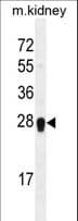 ARL5C Antibody (aa34-61)