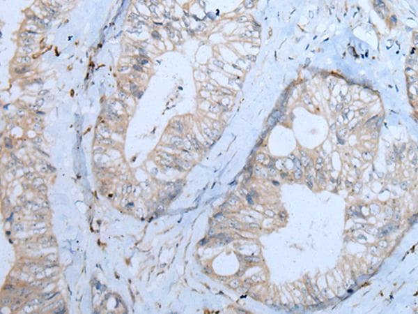 CNTN1 / gp135 / Contactin 1 Antibody