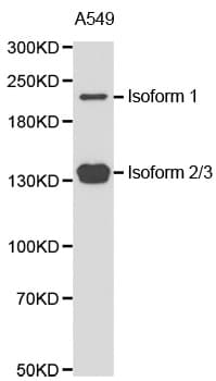 Polyclonal Rabbit anti-Human TET2 Antibody (WB)