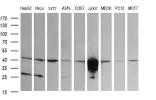 CD1C Antibody (clone OTI1E10)