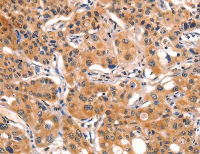 AIM2 Antibody