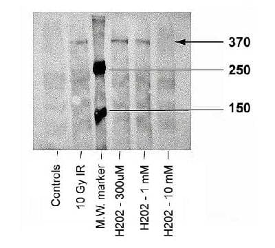 ATM Antibody (phospho-Ser1981, clone 10H11.E12, Biotin)