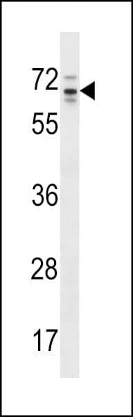 ARHGAP36 / FLJ30058 Antibody (aa373-402)