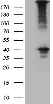 UP2 / UPP2 Antibody (clone OTI11F11)