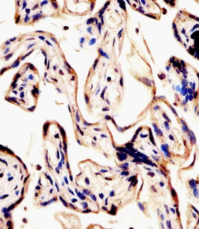 ERVK-7-Env Antibody (N-Terminus)
