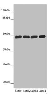 ST3GAL5 / GM3 Synthase Antibody