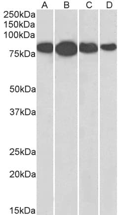 IHC-plus™ RDX / Radixin Antibody (aa537-548)