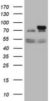 Monoclonal Mouse anti-Human GLB1 / Beta-Galactosidase Antibody (clone OTI1E10, IHC, WB)