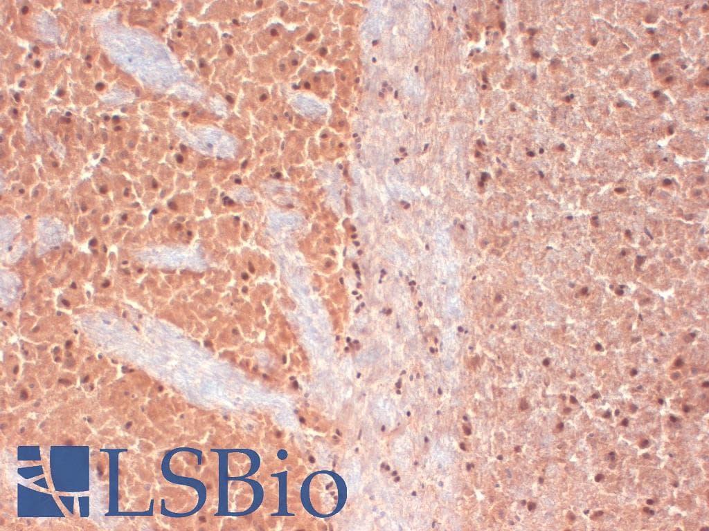 CACNA1H / Cav3.2 Antibody (aa1019-1293, clone S55-10, APC)