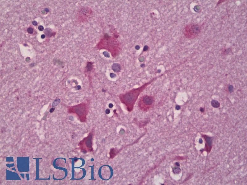 IHC-plus™ EPHX2 / Epoxide Hydrolase 2 Antibody