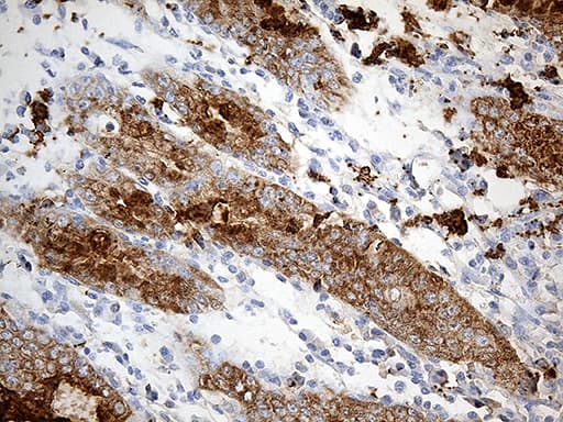 TFF1 / pS2 Antibody (aa25-84, clone OTI7B12)