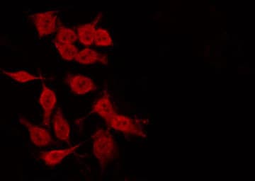TP53 / p53 Antibody (Acetyl-Lys317)