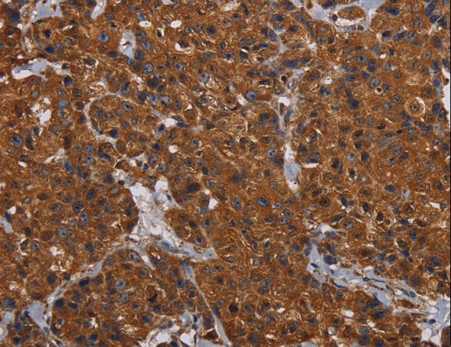 Polyclonal Rabbit anti-Human HYAL2 Antibody (IHC)