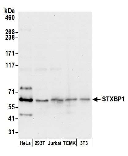 STXBP1 / MUNC18-1 Antibody (aa150-200)