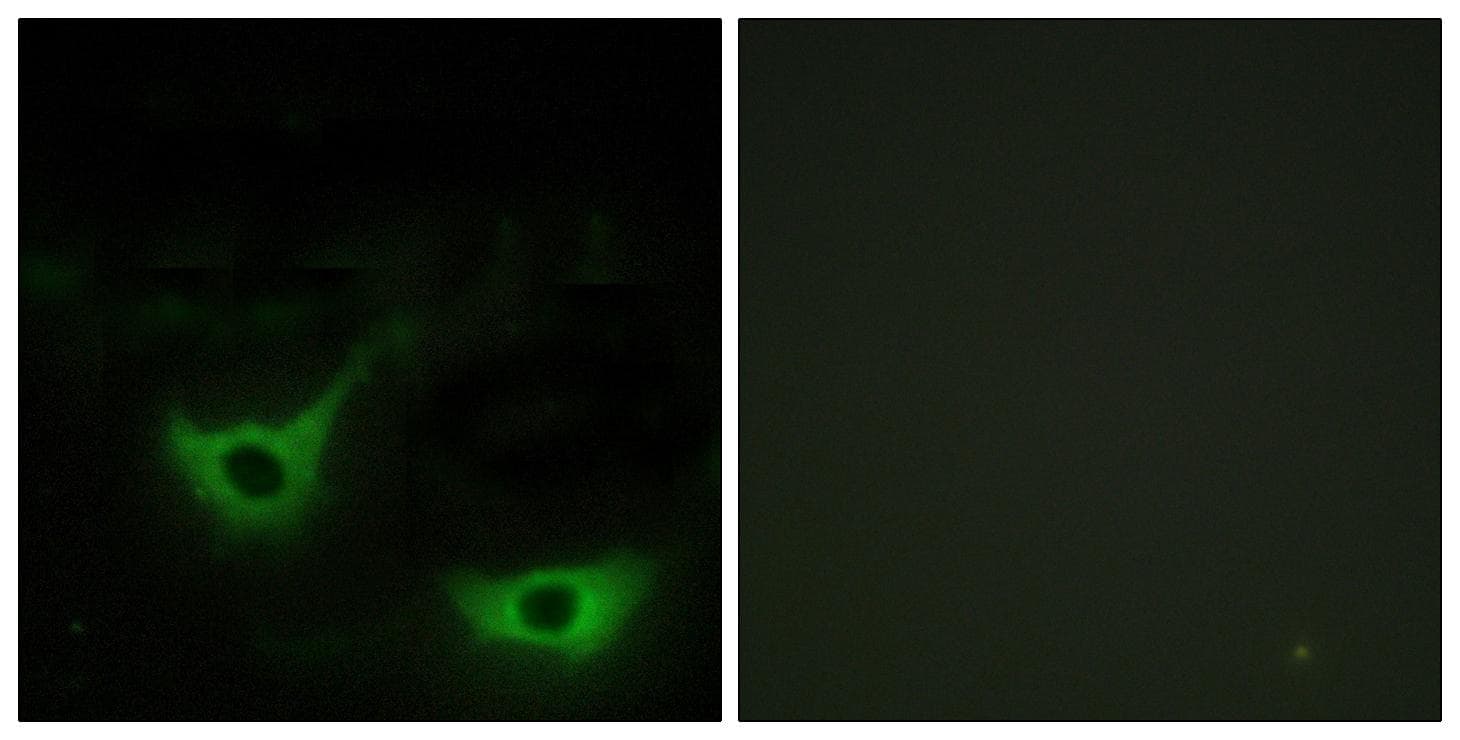 Polyclonal Rabbit anti-Human CALR / Calreticulin Antibody (IHC, IF, WB)