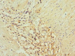 DDX / AKR1C3 Antibody (aa1-323)
