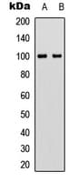 VAV2 Antibody (N-Terminus)