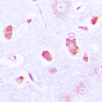 GUCY1A1 / GUCY1A3 Antibody (Internal)