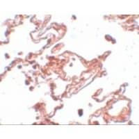 CCDC69 Antibody