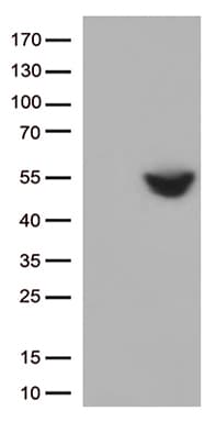 CD274 / B7-H1 / PD-L1 Antibody (clone OTI11G4)