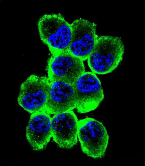 MBP / Myelin Basic Protein Antibody
