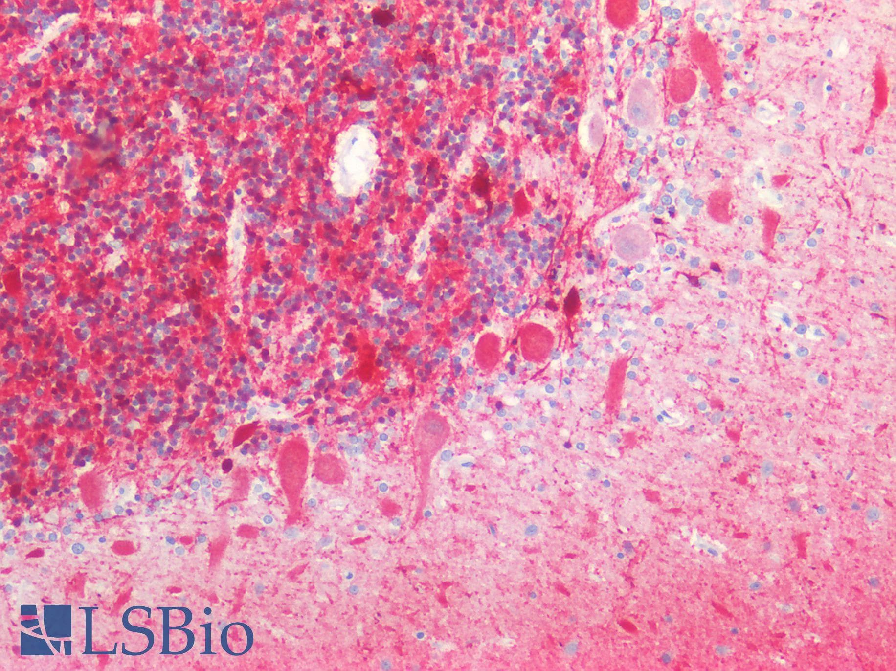 PathPlus™ Polyclonal Rabbit anti-Human CALB2 / Calretinin Antibody (IHC, WB)