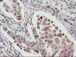PHF21B Antibody (clone OTI3D1)