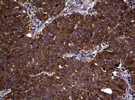 NME1 / NM23 Antibody (clone OTI6A11)