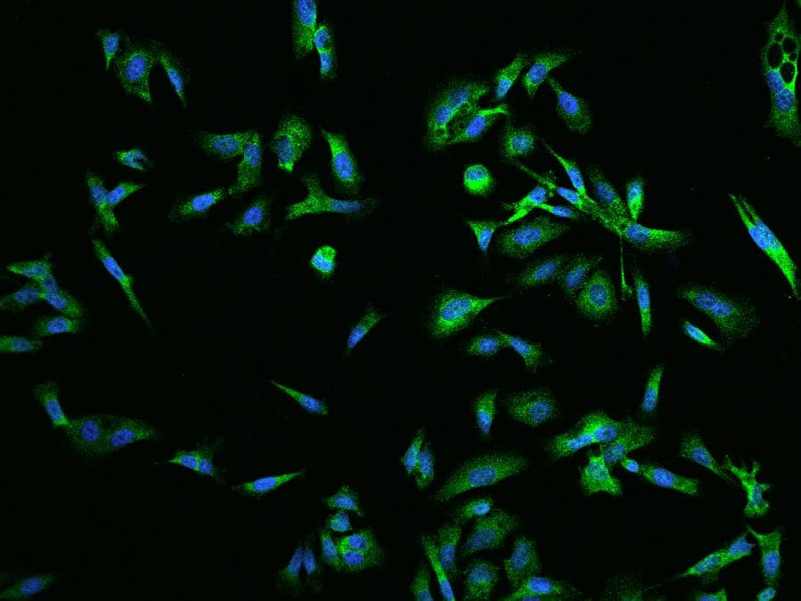 RAB5IF Antibody