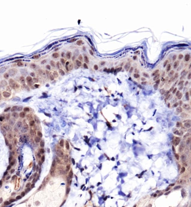 Collagen I Antibody