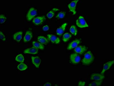 Polyclonal Rabbit anti-Human SNX12 Antibody (IHC, IF)