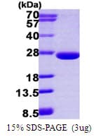 Human ARFL3 / ARL3 Protein (Recombinant His)