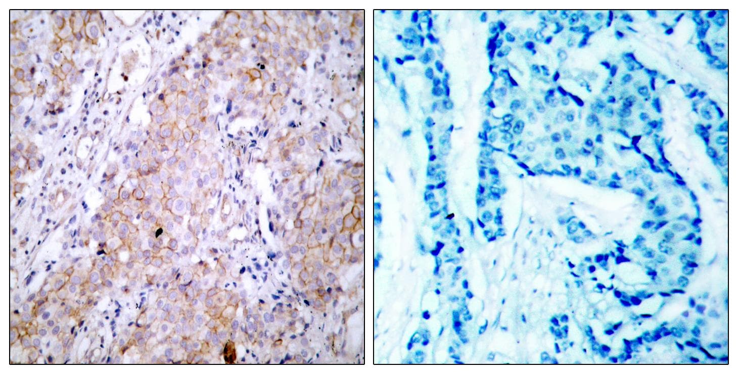 EGFR Antibody (p1070)