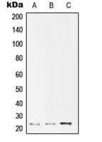 UBE2T / HSPC150 Antibody (Internal)