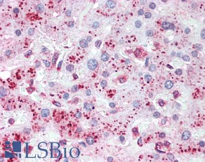 IHC-plus™ GAA / Alpha-Glucosidase, Acid Antibody
