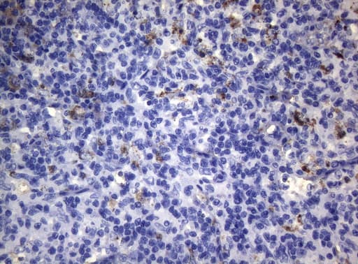 Monoclonal Mouse anti-Human CTSL / Cathepsin L Antibody (clone OTI8C12, IHC, WB)