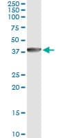 DNAJB6 Antibody (clone 1A5)