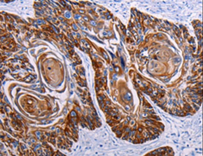 DEFA1 / Defensin Alpha 1 Antibody