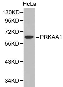 Polyclonal Rabbit anti-Human PRKAA1 / AMPK Alpha 1 Antibody (IHC, WB)