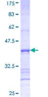 Human SLC27A3 Protein (Recombinant GST, N-terminus)
