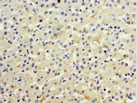 Polyclonal Rabbit anti-Human IL28B Antibody (aa22-196, IHC)