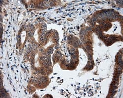 TLDC1 / KIAA1609 Antibody (clone OTI3C4, Carrier-free)