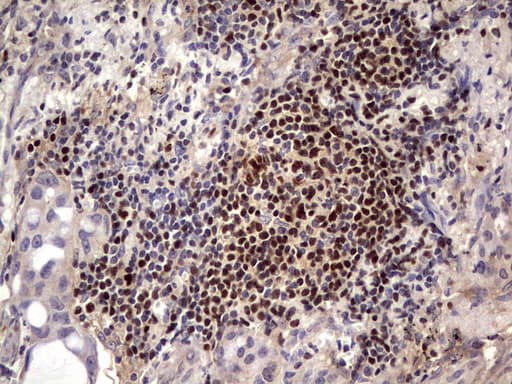 Monoclonal Mouse anti-Human IKZF3 / AIOLOS Antibody (clone OTI7E11, aa1-301, IHC, WB)