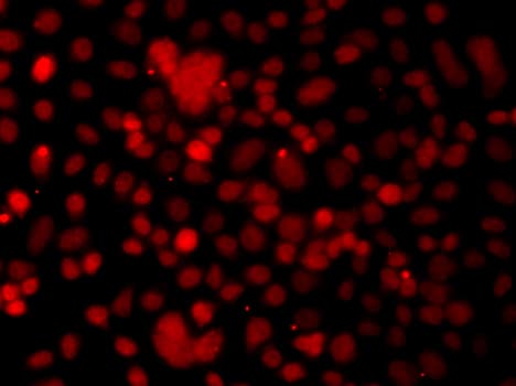 Polyclonal Rabbit anti-Human SNAI2 / SLUG Antibody (IHC, IF, WB)