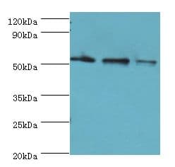 Polyclonal Rabbit anti-Human RMDN3 Antibody (aa171-470, IHC, WB)