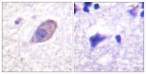 IHC-plus™ KCNJ16 / Kir5.1 Antibody (aa369-418)