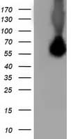 SQSTM1 Antibody (clone OTI7F6)