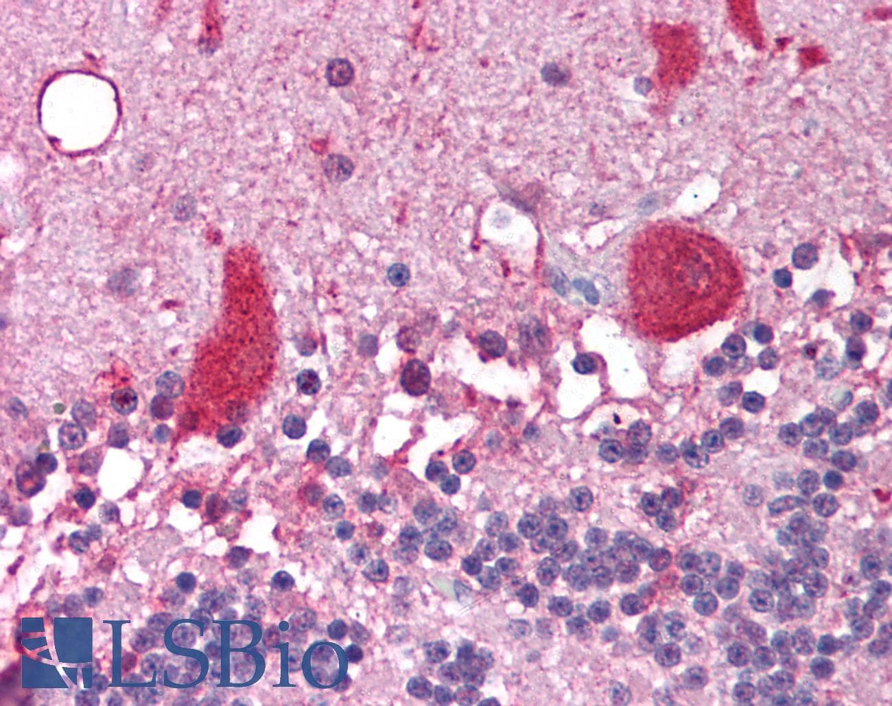 IHC-plus™ NCOA1 / SRC-1 Antibody (aa477-947, clone 1135)