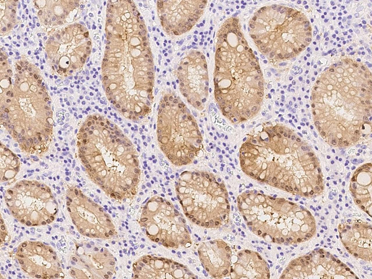 CASP14 / Caspase 14 Antibody (clone 20, Preservative Free)